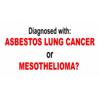 Oberheiden Law - Mesothelioma Attorneys